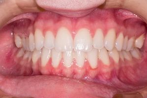 пасти за зъби без флуор - 62616 промоции