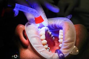 пасти за зъби без флуор - 45399 разновидности