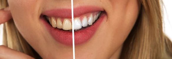 пасти за зъби без флуор - 31154 постижения